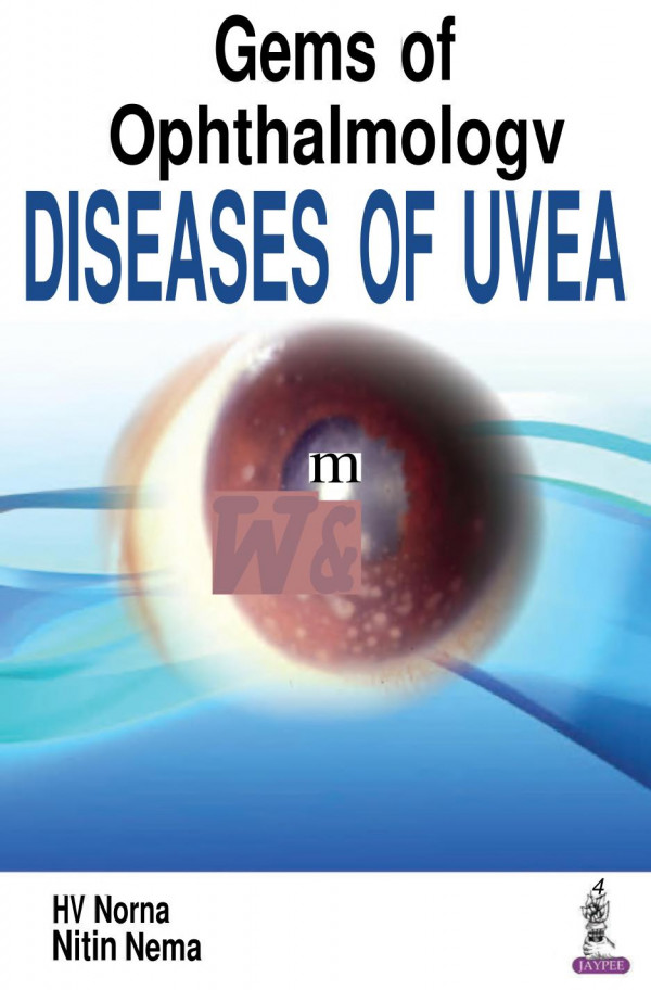Gems Of Ophthalmologydiseases Of Uvea May 1 20189352702727jaypee Brothers Medical Pub Hv Nema