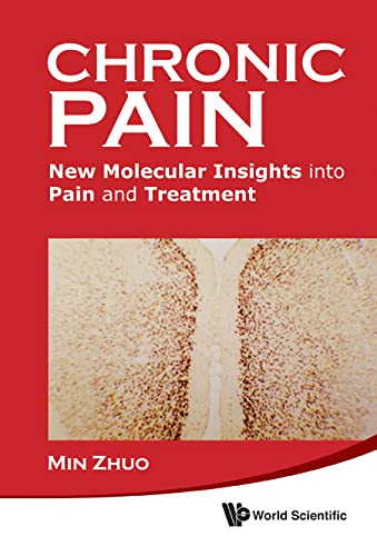 Chronic Pain New Molecular Insights Into Pain And Treatment Min Zhuo
