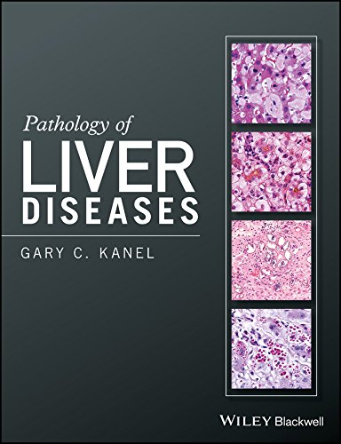 Pathology Of Liver Diseases 1st Edition Kanel Gary C