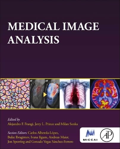 Medical Image Analysis The Miccai Society Book Series 1st Edition Alejandro Frangi
