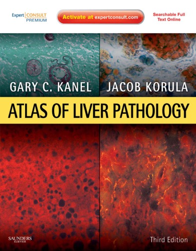Atlas Of Liver Pathology 3rd Edition Gary C Kanel Jacob Korula