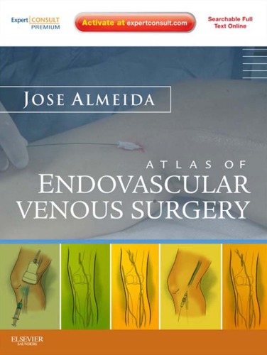 Atlas Of Endovascular Venous Surgery Jos Almeida