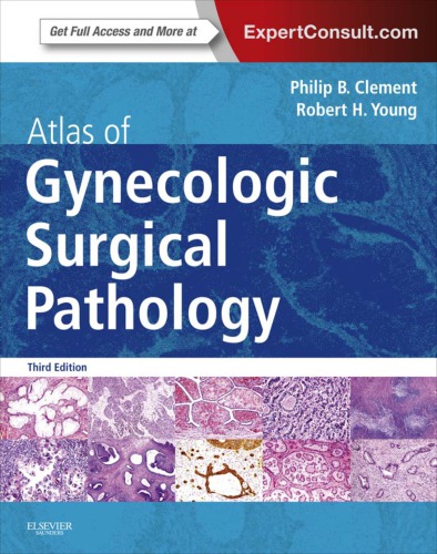 Atlas Of Gynecologic Surgical Pathology 3rd Phillip B Clement