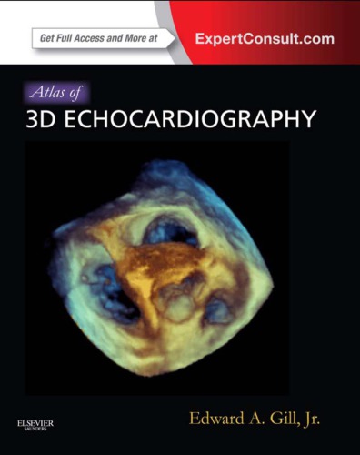 Atlas Of 3d Echocardiography Edward A Gill