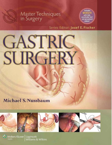 Gastric Surgery 1st Edition Michael S Nussbaum