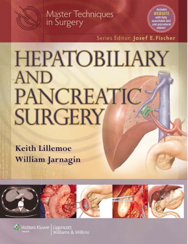 Hepatobiliary And Pancreatic Surgery 1st Edition Keith Lillemoe