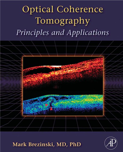 Optical Coherence Tomography Principles And Applications Brezinski