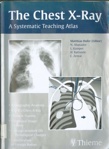The Chest Xray A Systematic Teaching Atlas 1st Edition Matthias Hofer