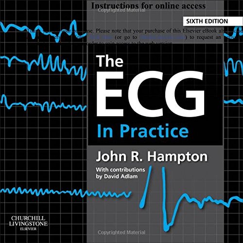 The Ecg In Practice 6th Edition John R Hampton David Adlam