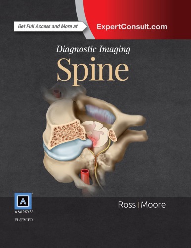 Diagnostic Imaging Spine Ross Moore