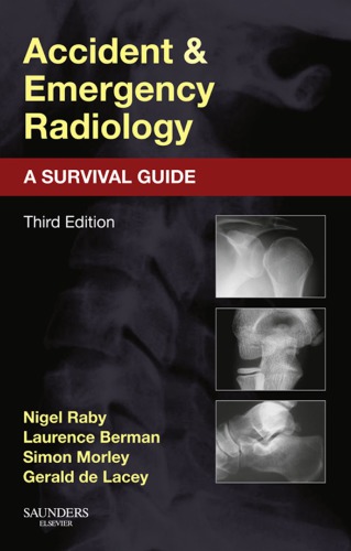 Accident And Emergency Radiology A Survival Guide Nigel Raby