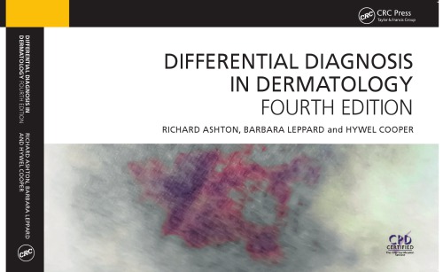 Differential Diagnosis In Dermatology 4th Richard Ashton Barbara Leppard