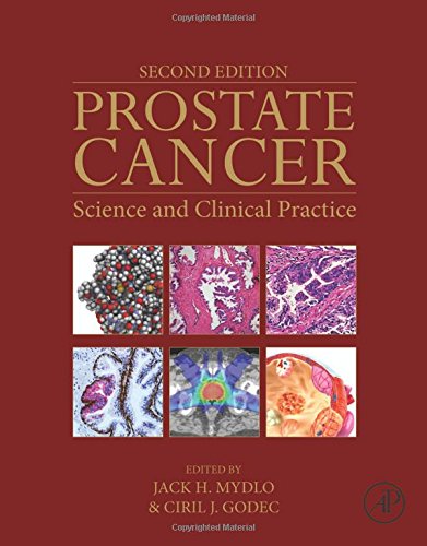 Prostate Cancer Second Edition Science And Clinical Practice Second Edition Jack H Mydlo Md Facs