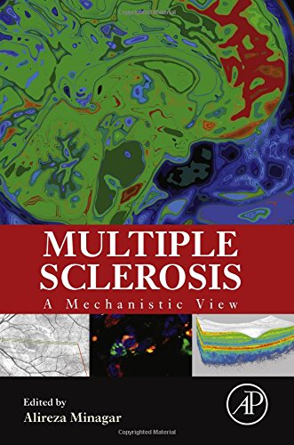 Multiple Sclerosis A Mechanistic View 1st Edition Alireza Minagar Md Faan