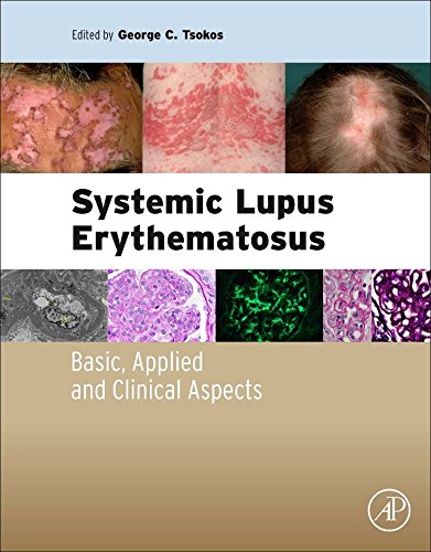 Systemic Lupus Erythematosus Basic Applied And Clinical Aspects 1st Edition George Tsokos