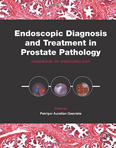 Endoscopic Diagnosis And Treatment In Prostate Pathology Handbook Of Endourology 1st Edition Geavlete