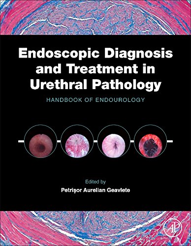 Endoscopic Diagnosis And Treatment In Urethral Pathology Handbook Of Endourology 1st Edition Petrisor Aurelian Geavlete