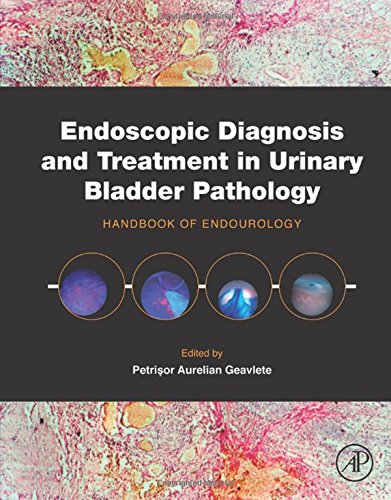 Endoscopic Diagnosis And Treatment In Urinary Bladder Pathology Handbook Of Endourology 1st Edition Geavlete