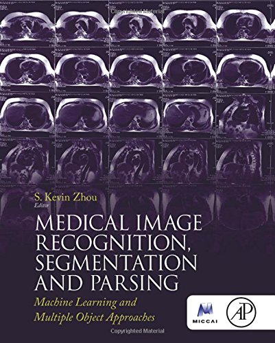 Medical Image Recognition Segmentation And Parsing Machine Learning And Multiple Object Approaches 1st Edition Zhou