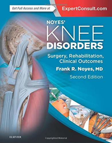 Noyes Knee Disorders Surgery Rehabilitation And Clinical Outcomes 2nd Edition Noyes Md
