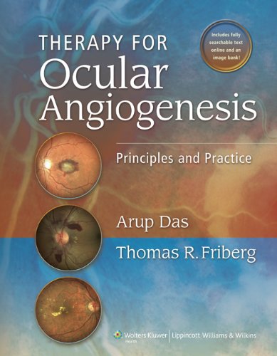 Therapy For Ocular Angiogenesis Principles And Practice 1st Edition Arup Das