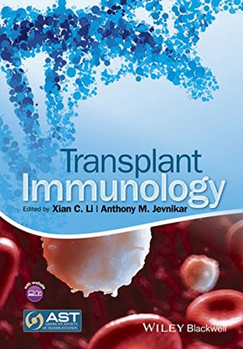 Transplant Immunology 1st Edition Xian C Li M Jevnikar Anthony