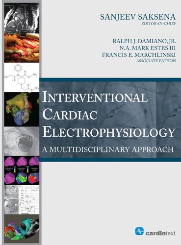 Interventional Cardiac Electrophysiology A Multidisciplinary Approach 1st Edition Sanjeev Saksena