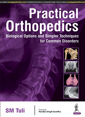Practical Orthopedics Biological Options And Simpler Techniques For Common Disorders 1e Tuli Sm