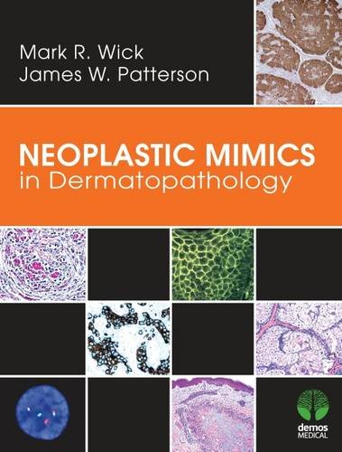 Neoplastic Mimics In Dermatopathology 1st Edition Mark R Wick Md