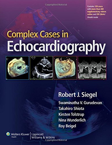 Complex Cases In Echocardiography 1st Edition Robert J Siegel Et Al