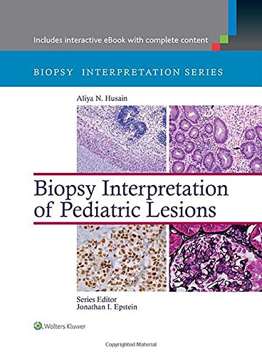 Biopsy Interpretation Of Pediatric Lesions First Aliya N Husain Md