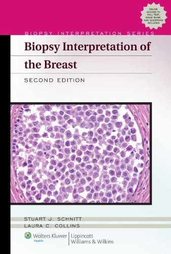 Biopsy Interpretation Of The Breast Second Stuart J Schnitt Laura C Collins
