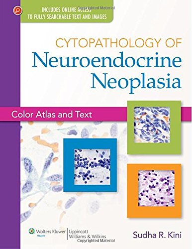 Cytopathology Of Neuroendocrine Neoplasia Color Atlas And Text 1 Harpsc Sudha R Kini Md