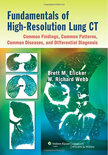 Fundamentals Of Highresolution Lung Ct Common Findings Common Patterns Common Diseases And Differential Diagnosis 1st Edition Brett M Elicker Md