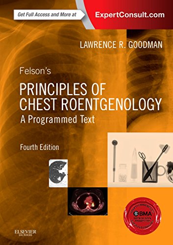 Felsons Principles Of Chest Roentgenology A Programmed Text 4th Edition Lawrence R Goodman
