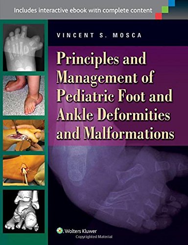 Principles And Management Of Pediatric Foot And Ankle Deformities And Malformations 1st Edition Vincent S Mosca
