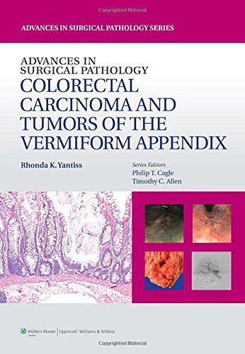 Advances In Surgical Pathology Colorectal Carcinoma And Tumors Of The Vermiform Appendix 1st Edition Rhonda Yantiss