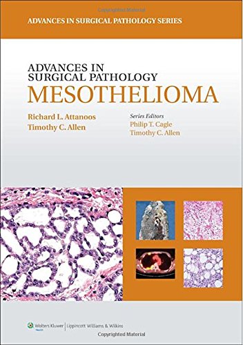 Advances In Surgical Pathology Mesothelioma 1st Edition Richard L Attanoos