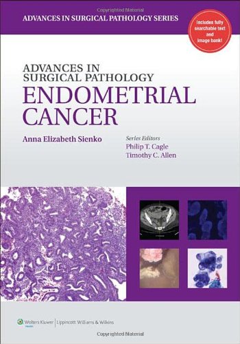 Advances In Surgical Pathology Endometrial Carcinoma 1st Edition Anna Sienko