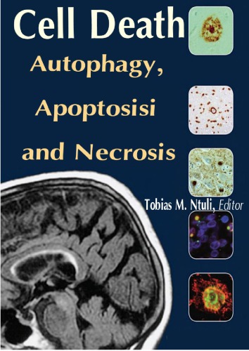 Cell Death Autophagy Apoptosisi And Necrosis Tobias M Ntuli