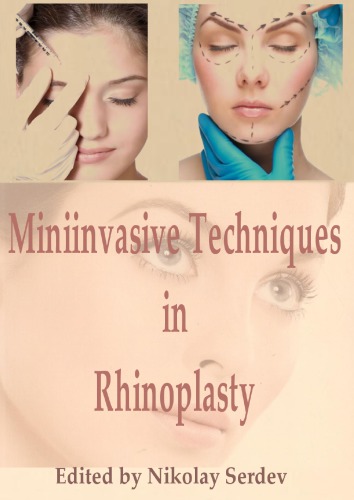 Miniinvasive Techniques In Rhinoplasty Nikolay Serdev