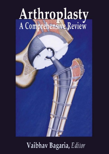 Arthroplasty A Comprehensive Review Vaibhav Bagaria