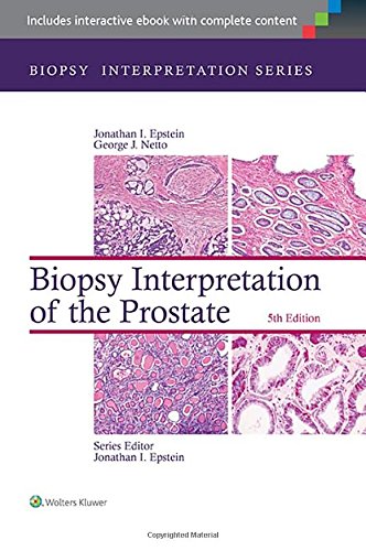 Biopsy Interpretation Of The Prostate 5th Edition Jonathan I Epstein