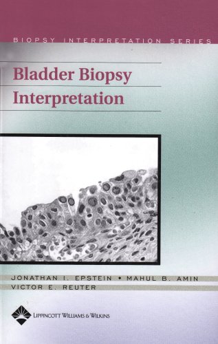 Bladder Biopsy Interpretation Jonathan I Epstein Mahul B Amin