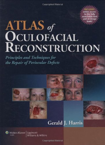 Atlas Of Oculofacial Reconstruction Principles And Techniques For The Repair Of Periocular Defects 1 Harpsc Gerald J Harris Md Facs
