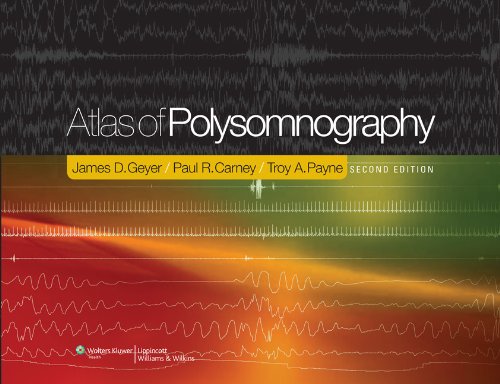 Atlas Of Polysomnography Second James D Geyer Md Paul R Carney Md