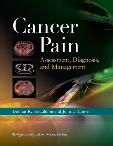 Cancer Pain Assessment Diagnosis And Management 1st Edition Dermot R Fitzgibbon Mb Bch