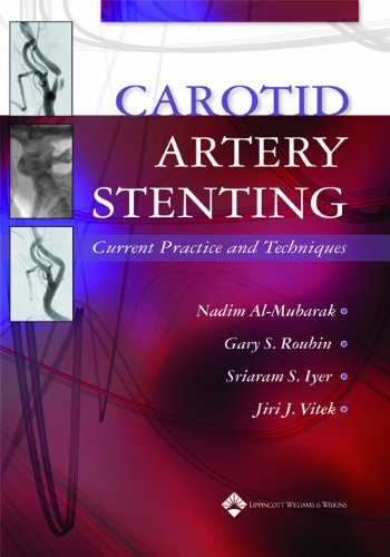 Carotid Artery Stenting Current Practice And Techniques 1st Edition Nadim Almubarak Md