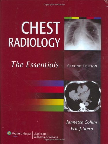 Chest Radiology The Essentials Second Jannette Collins Md Med