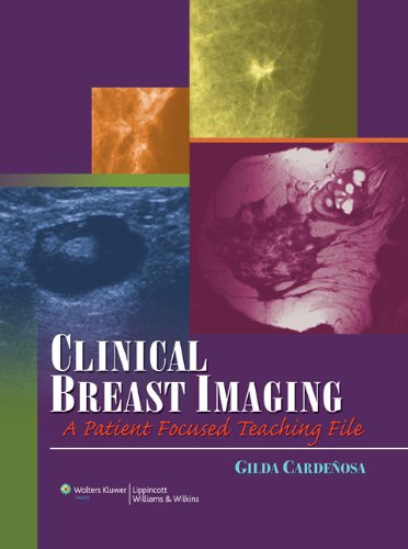 Clinical Breast Imaging A Patient Focused Teaching File 1st Edition Gilda Cardenosa Md Facr